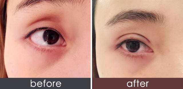 2023馬鞍山鐳射祛斑醫(yī)生前十位排行榜(石京頤、石京頤、周曉晶排名不分先后，一睹為快~)