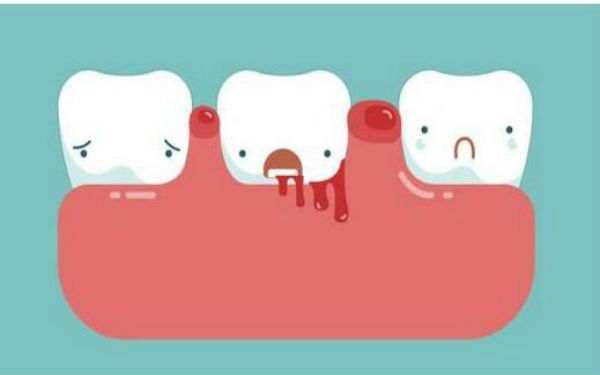 2023海南PRP自體細(xì)胞除皺排名榜前十位的專家(李磊、代漢語(yǔ)、劉廣志選它)