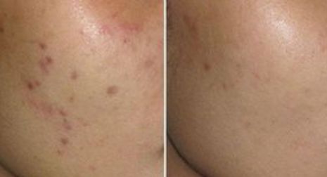 成都星范醫(yī)療美容整形醫(yī)院的醫(yī)生口碑如何？