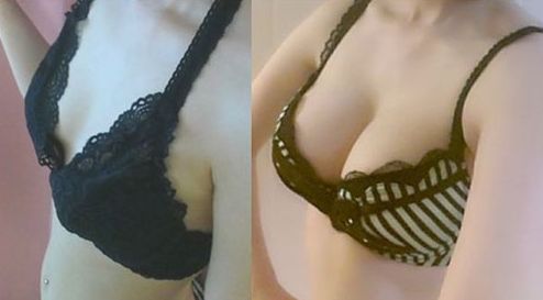 廣州哪家醫(yī)院做微針好？解讀廣州市內(nèi)頂尖微針治療機構(gòu)