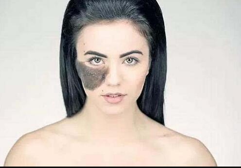 北京比較好的整容醫(yī)院楊欣的吸脂減肥技術(shù)效果如何？