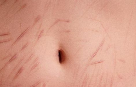 亳州哪家雙眼皮醫(yī)院口碑好，值得信賴？