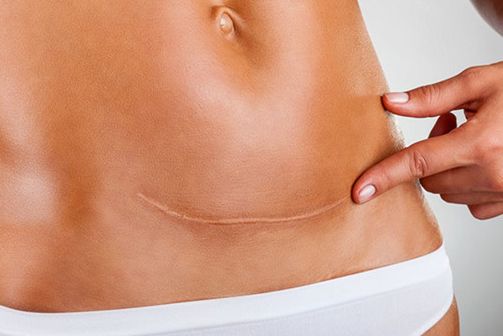 2023西安雙眼皮最佳醫(yī)院排行榜：哪家醫(yī)院的雙眼皮效果好？