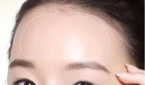 常州治療脫發(fā)哪家醫(yī)院靠譜？