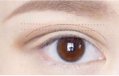 佛山哪家整容醫(yī)院的隆鼻效果出色？