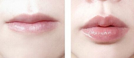 鄭州整形哪家醫(yī)院好？挑選進(jìn)修整形要注意的要點(diǎn)有哪些呢？