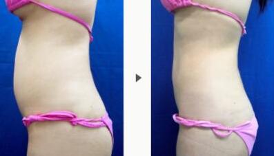 北京受歡迎的隆鼻醫(yī)生有哪些？揭秘5位經(jīng)驗(yàn)豐富且備受好評(píng)的醫(yī)療專(zhuān)家