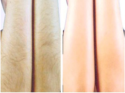 2023徐州小切口除皺修復(fù)權(quán)威醫(yī)生排名前幾(李輝、曹洪揚、彭衛(wèi)東實力行業(yè)領(lǐng)先！)