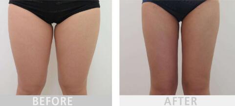 福州五位整形醫(yī)生名單首發(fā)，王彪、王美水等幫你塑造完美五官！