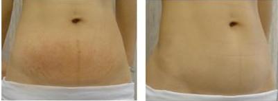 2023福州改善眼角皺紋專家排行榜前十位(徐婷婷、鄭少雄、李夢收費標(biāo)準(zhǔn)不貴)