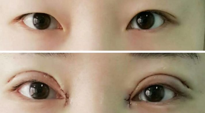 貴陽哪家醫(yī)院熱瑪吉效果好，值得推薦？