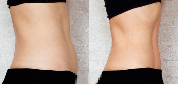 上海祛斑術哪家醫(yī)院好？解讀上海祛斑術醫(yī)院排名和專家推薦