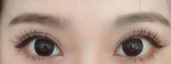 西安哪家醫(yī)院的激光祛痘項目質(zhì)量好？