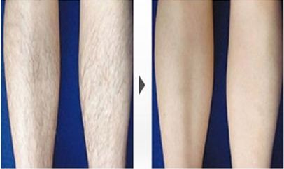 哈爾濱哪家醫(yī)院祛斑好？-排名第一的專業(yè)醫(yī)院，讓您擁有無瑕疵肌膚！