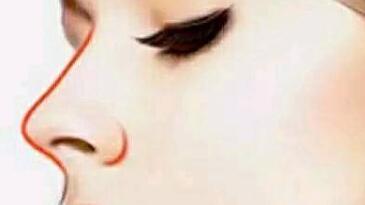 廣州安美國(guó)際林立荃醫(yī)生的個(gè)人簡(jiǎn)歷和令人驚嘆的除皺抗衰案例分享