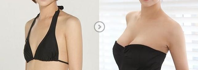 鄭州瘦臉針效果如何？一起探討哪家醫(yī)院好！