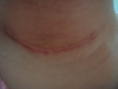 2023徐州玻尿酸注射法令紋醫(yī)生前10強口碑榜(俞曉江、程洋、劉迎迎靠譜醫(yī)院，安心選！)