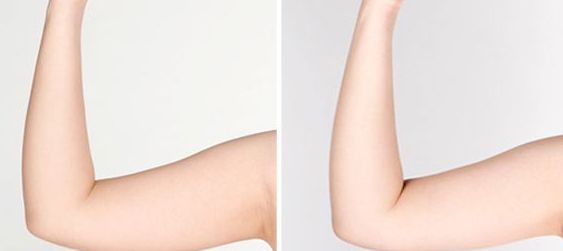 宿州雙眼皮醫(yī)院哪家好？揭秘宿州地區(qū)專業(yè)雙眼皮整形醫(yī)院