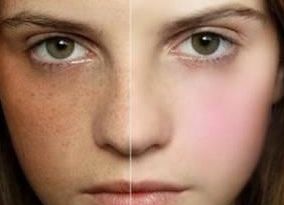 宿州疤痕修復(fù)醫(yī)院哪家好？幫你選擇最適合的宿州疤痕治療?？漆t(yī)院