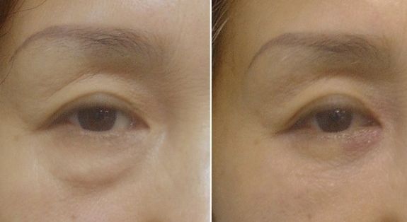 解放軍總裝備部后勤部亞運(yùn)村門(mén)診部怎么樣？解放軍總裝備部后勤部亞運(yùn)村門(mén)診部簡(jiǎn)介|醫(yī)生團(tuán)隊(duì)|口碑評(píng)價(jià)！