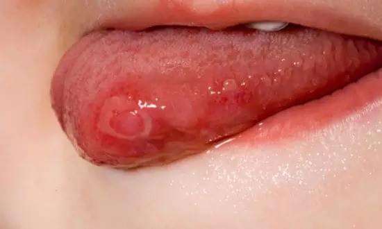 2023廣東內(nèi)切眼袋手術(shù)排行前十位專家(杜永軍、蔡劍芳、王綏江深得老用戶口碑)