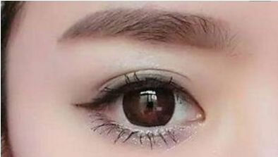 長沙哪位醫(yī)生擅長解燦割雙眼皮技術(shù)？