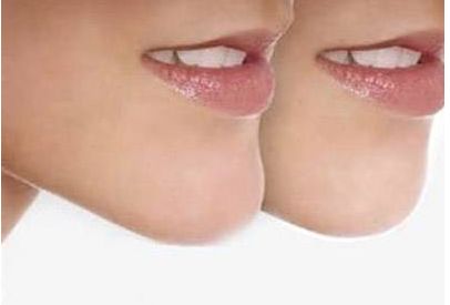 嘉興割雙皮哪家醫(yī)院好？為您推薦嘉興市內(nèi)專業(yè)割雙皮醫(yī)院排行榜