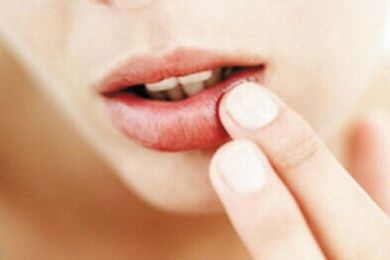 2023濟南激光祛眼睛細紋醫(yī)生前10強排名榜(李文德、王曉林、趙峰值得信賴和選擇！)