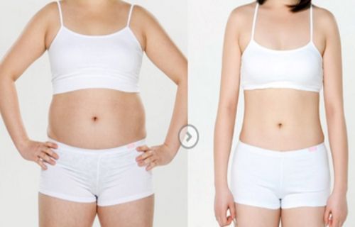 合肥哪家醫(yī)院去痘坑好？選擇最適合您皮膚需求的醫(yī)院