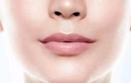 上海知名整形師楊亞益、陳紅梅、吳海龍帶給你完美雙眼角！