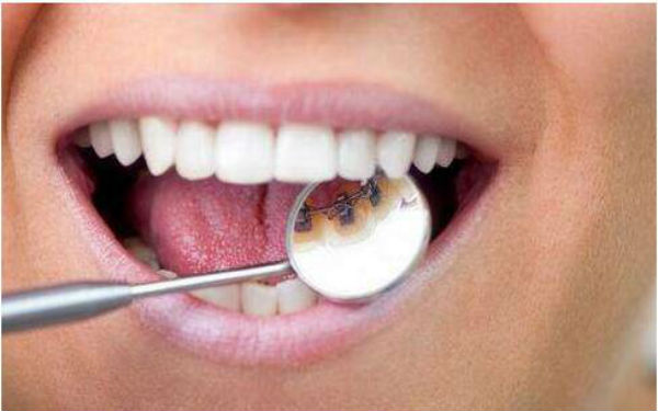 2023杭州純手工負(fù)壓吸脂精雕術(shù)排行前10位醫(yī)生(賈明、桑宇奇、周慎健測(cè)評(píng)榜追擊不踩雷)