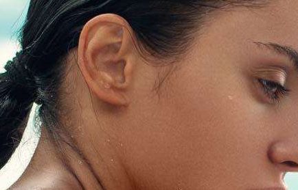 福州胎記?？漆t(yī)院哪家好？解析福州市胎記治療醫(yī)院排名