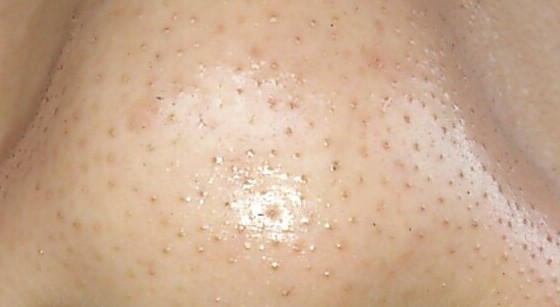 2023承德自體脂肪填充塑型前十名的專家(魏國祥、王紅、韓永剛都是高人氣專家！)