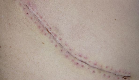 杭州整形醫(yī)院哪家服務(wù)好？選擇杭州整形醫(yī)院前需了解的幾點關(guān)鍵因素