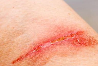 重慶去眼袋醫(yī)院哪家好？專業(yè)醫(yī)生推薦最佳醫(yī)院解決眼袋問題