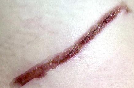 吉林市眼袋修復(fù)哪家醫(yī)院好？