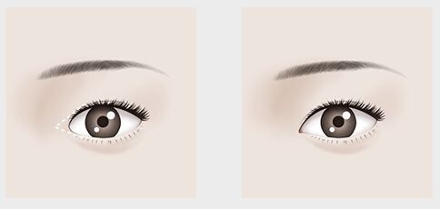 上海乳腺疾病醫(yī)院排名及解讀：哪家醫(yī)院專業(yè)、權(quán)威、信賴？