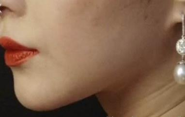 2023南寧1+N多效雙眼皮專家排行榜前10名(王昌松、徐贊正、朱格非口碑、實力一一盤點)