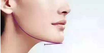 蘭州雀斑問(wèn)題煩惱？快來(lái)尋找最佳治療方法，推薦多家正規(guī)醫(yī)院！