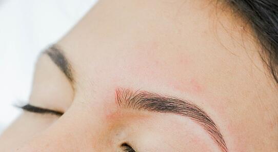 北京喬雅登名醫(yī)挖掘，新榜單首揭誰更強(qiáng)？技術(shù)絕優(yōu)對(duì)決揭曉！