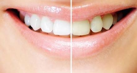 南方醫(yī)院董自清做面部脂肪填充效果如何？樸素自然且光滑無痕，沒有坑洼效應(yīng)嗎？