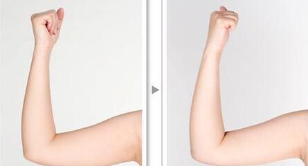 北醫(yī)三院謝詳主刀點(diǎn)評：五星植發(fā)案例驚艷登場