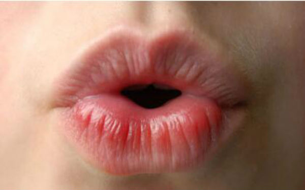 2023成都抬頭紋剝離大型醫(yī)生(董灜、周斌、劉國權(quán)當(dāng)屬當(dāng)?shù)孛麣飧?