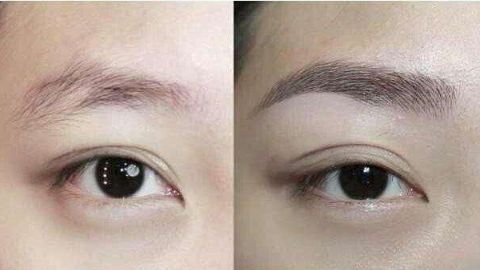 樸相炫醫(yī)生雙眼皮效果怎么樣？真實(shí)用戶口碑分享！