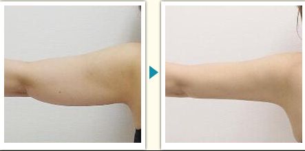 衢州市整容醫(yī)院哪家好？了解衢州市整容醫(yī)院的專業(yè)團(tuán)隊(duì)和先進(jìn)設(shè)備