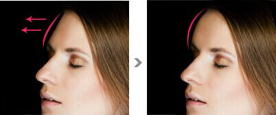 2023天津去眼部皺紋醫(yī)生推薦前10名(申銳湜、陳山偉、朱曉峰專家實(shí)力細(xì)數(shù)、價(jià)格公布)