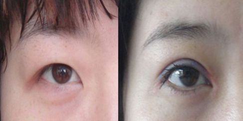 蘭州中藥祛斑哪家醫(yī)院好？解析蘭州本地祛斑療法和專業(yè)醫(yī)院推薦