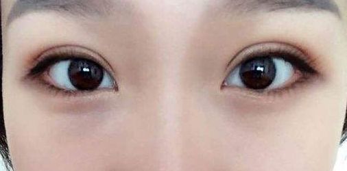 永州地區(qū)哪家正規(guī)整形醫(yī)院好？