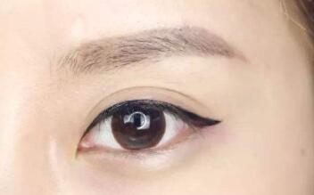 朱春艷醫(yī)師解析雙眼皮技術(shù)與手術(shù)方式，附詳細(xì)醫(yī)生介紹和診療科室信息