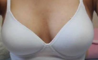 2023成都骨膠原填充下巴權(quán)威專家評(píng)價(jià)前十名(李媚、馮牧夷、葛振國(guó)綜合實(shí)力靠前！)